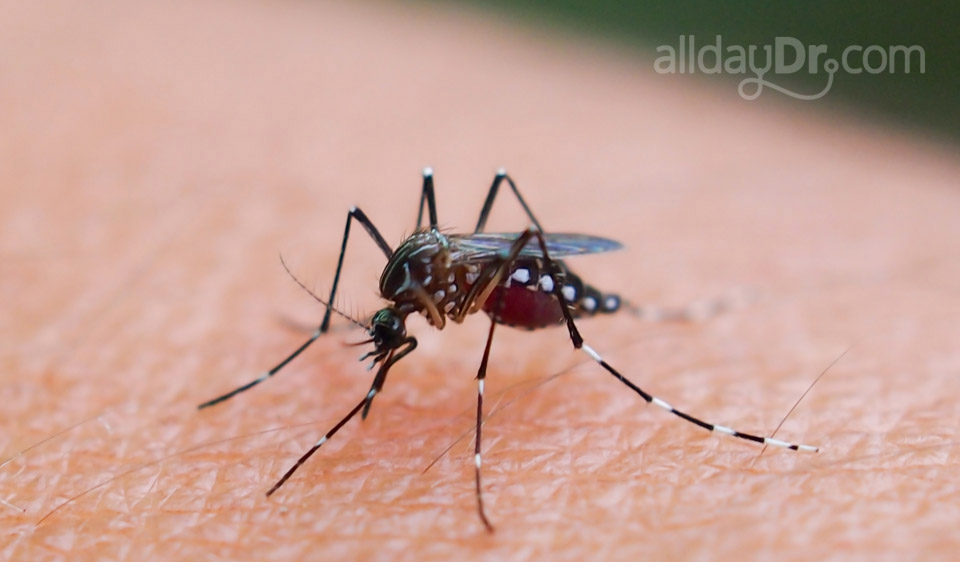 Malaria Malaria
